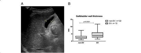 best location to measure gallbladder wall thickness|gallbladder wall thickening procedure.